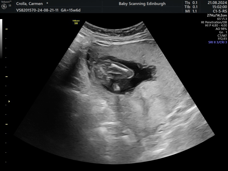 16 week gender reveal images