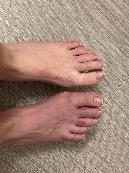 The doctor doesn't know what's wrong with my foot