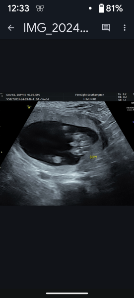 Gender of scan images