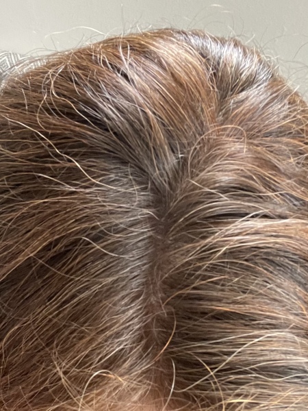 Hair dyelemma! (see what I did there)