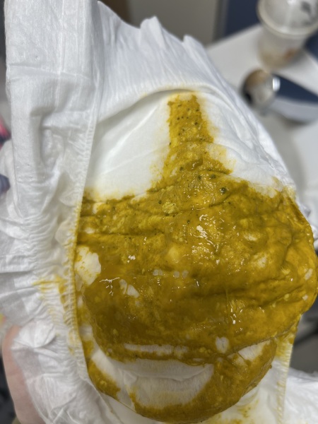 Black grit in baby poop