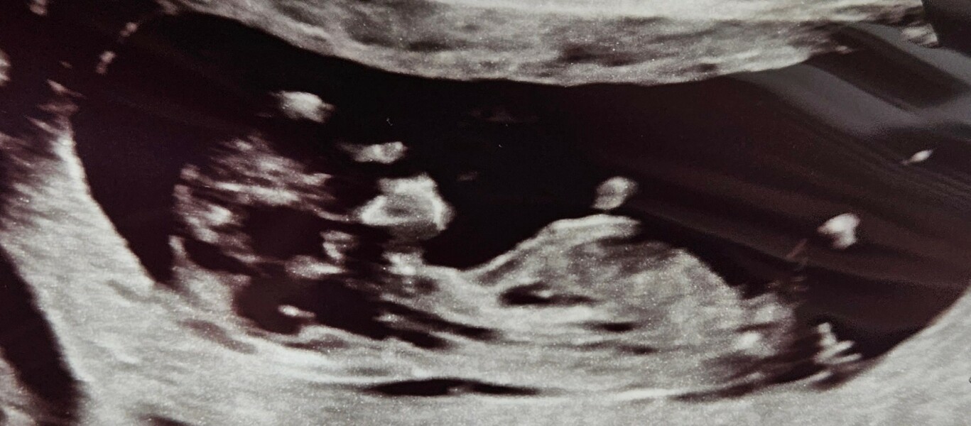 Nub theory, just for fun, 12 weeks exactly!