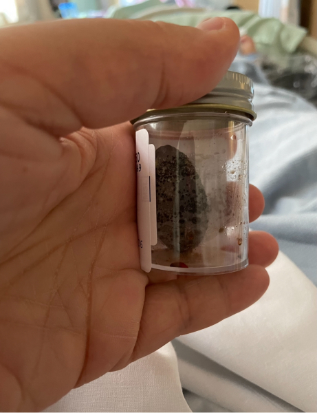 Gallbladder op - FAQs and words of comfort and wisdom