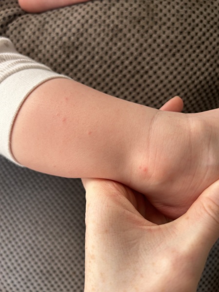 Does anyone recognise this rash/spots?