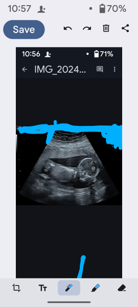 Gender of scan images