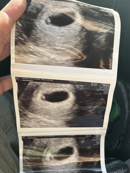 Due April 2025 ✨