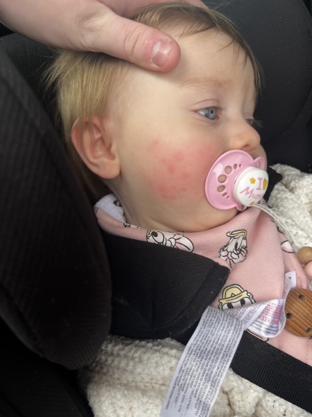 Weird spots that calm down and flair up