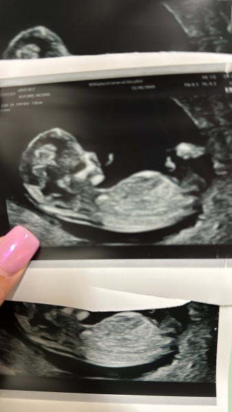 Boy or girl nub theory?? Xxxxx