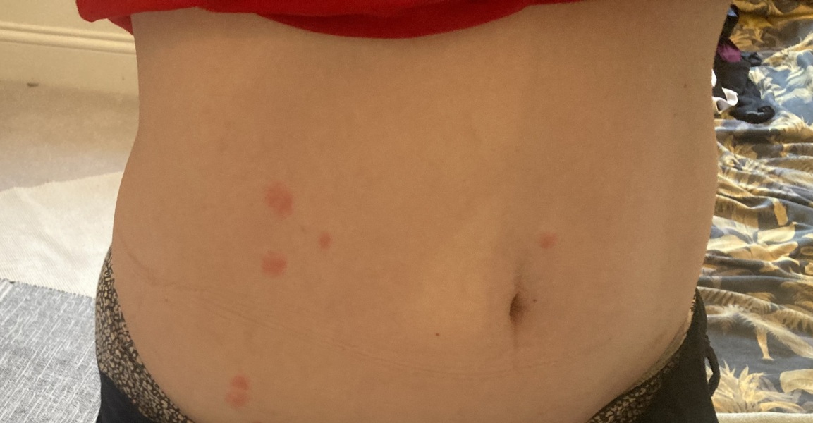 What the hell has bitten me?!