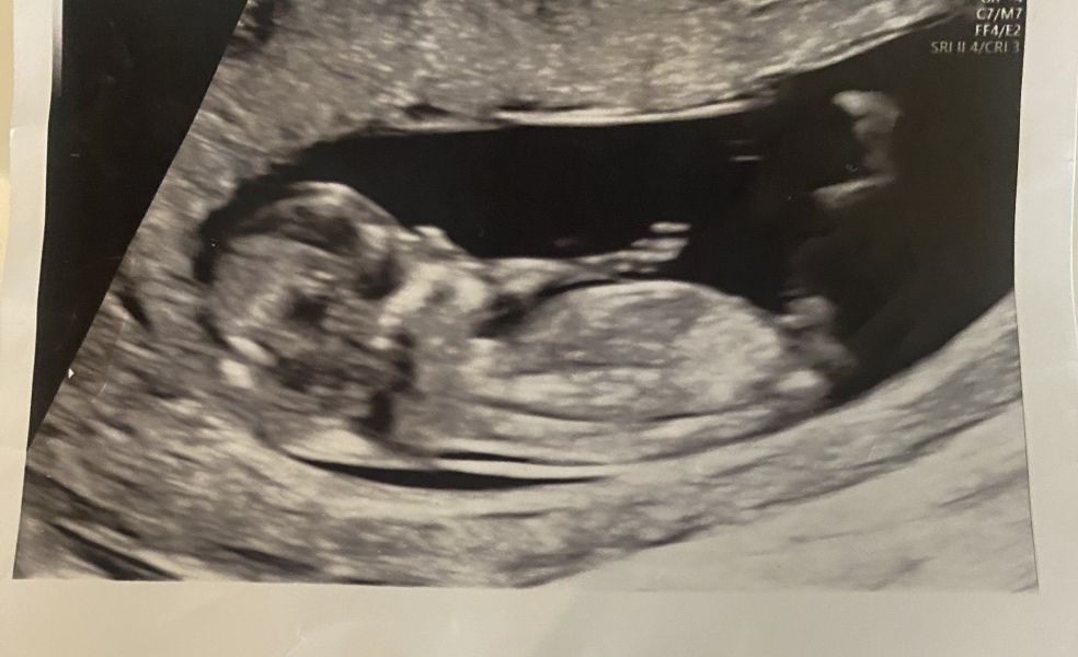 Boy or girl