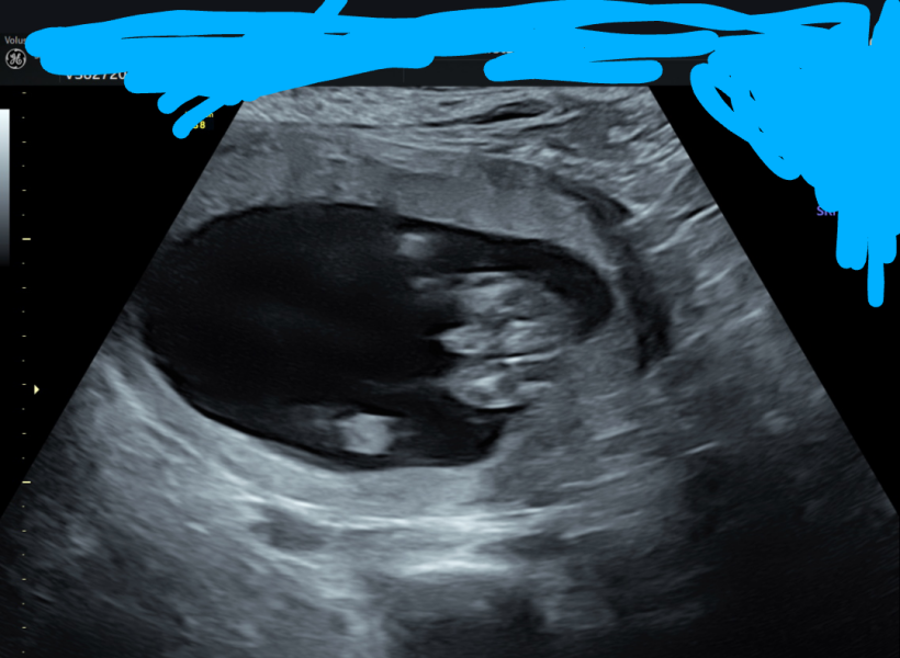 Gender of scan images