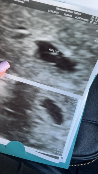 Early scan :(
