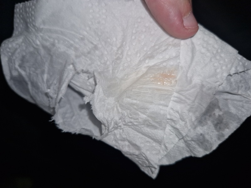 Has anyone experienced Implantation pain/bleeding