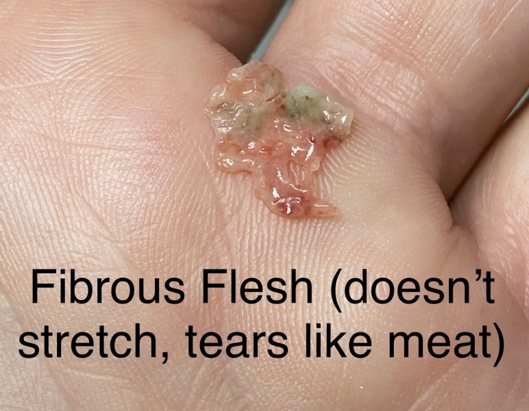 Any idea what this could be...GROSS PIC INCLUDED