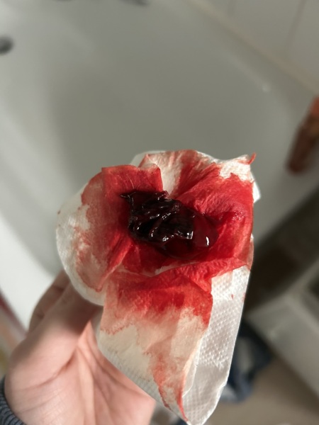 Graphic photo included! Heavier period than normal, largish clots