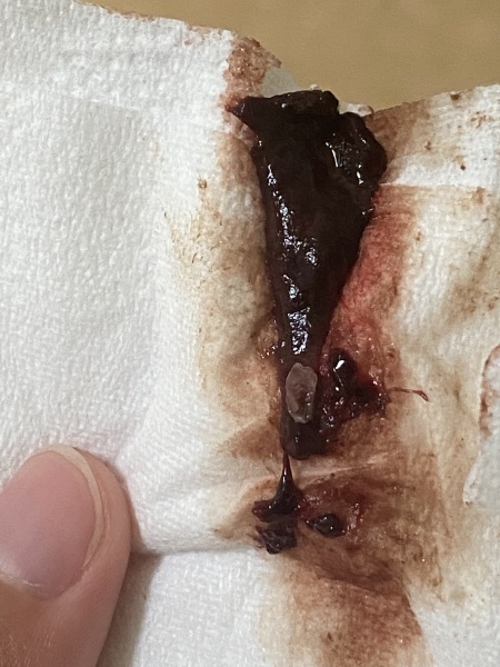 Could these be miscarriages?