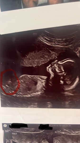 Does anyone else see gender clues in circled area?