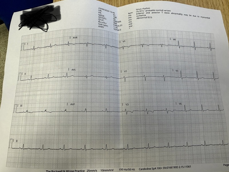Abnormal ECG and breathlessness
