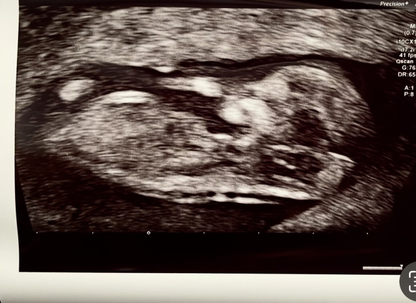 Boy or girl?