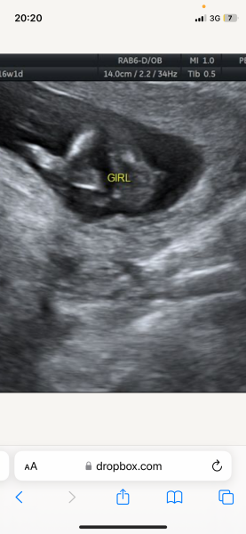 Boy or girl