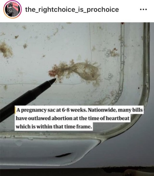 To think people shouldn't have sex with people unless you would both be happy and able to raise children together?