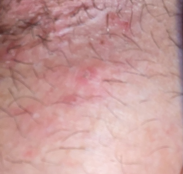 What’s this in my groin? *TMI alert*