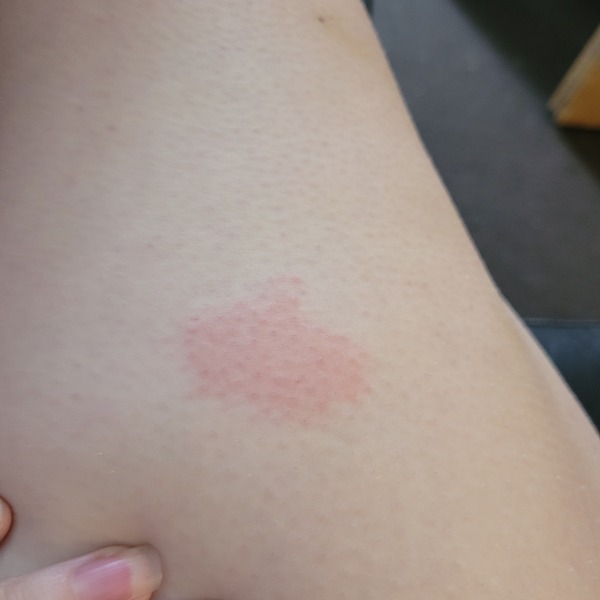 Mid July Mounjaro starters #2