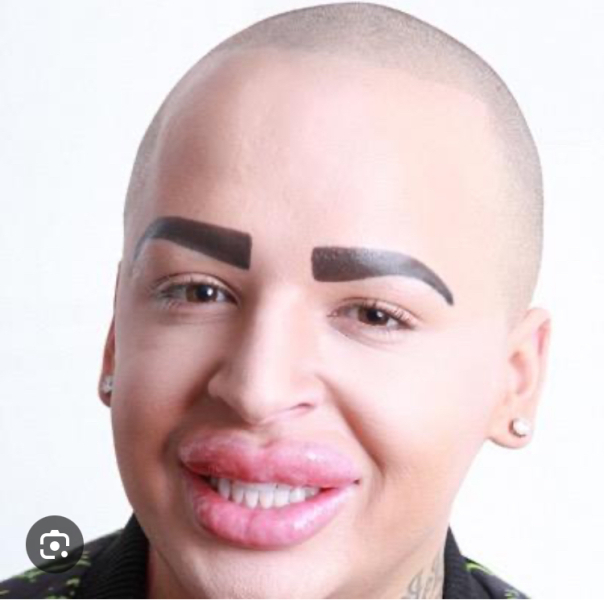 To think that 5 children growing up motherless because their Mum wanted cosmetic surgery is absolutely tragic *edited by MNHQ