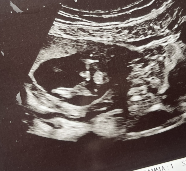 Gender of scan images