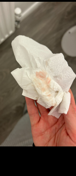 Implantation bleeding twice?