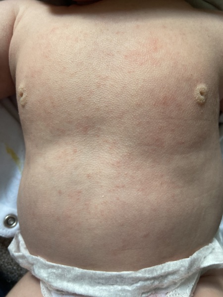 Can mucus in newborn poo be normal?