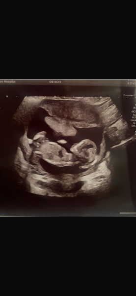 Boy or Girl