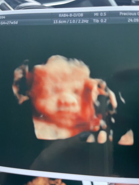 4D scan guess boy or girl?