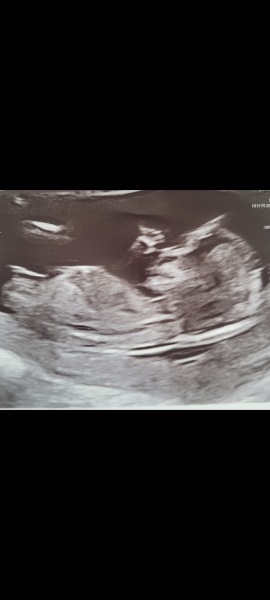 Any guesses on the sex?!