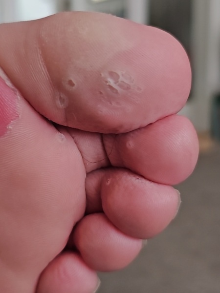 What could these multiple holes be on his foot?