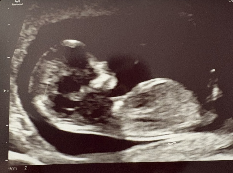 Gender Guesses