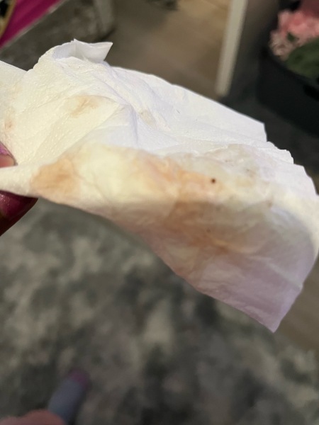 Is this implantation bleeding ?