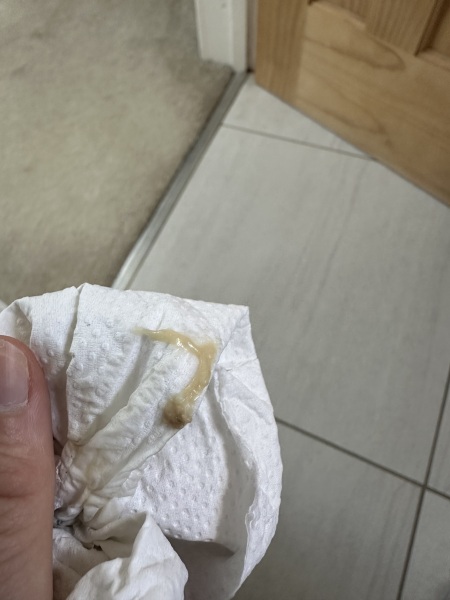 Brown discharge - photo warning TMI!