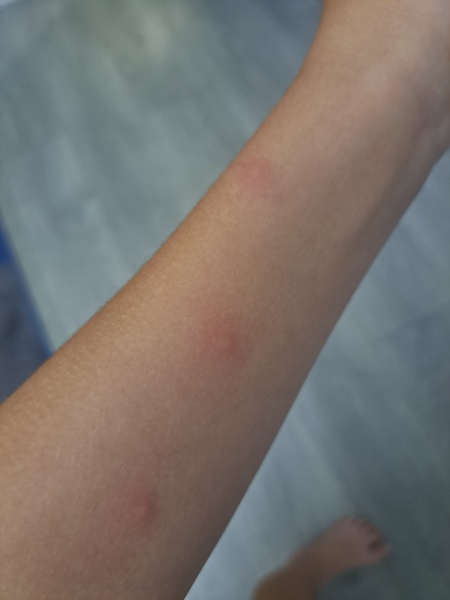 To ask what these spots are