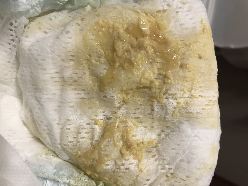 Pale poo *IMAGE INCLUDED*