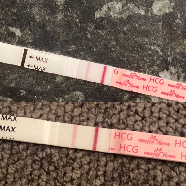 Pregnancy Anxiety