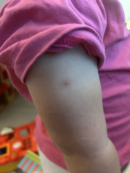 Anyone have any clue what these spots are?