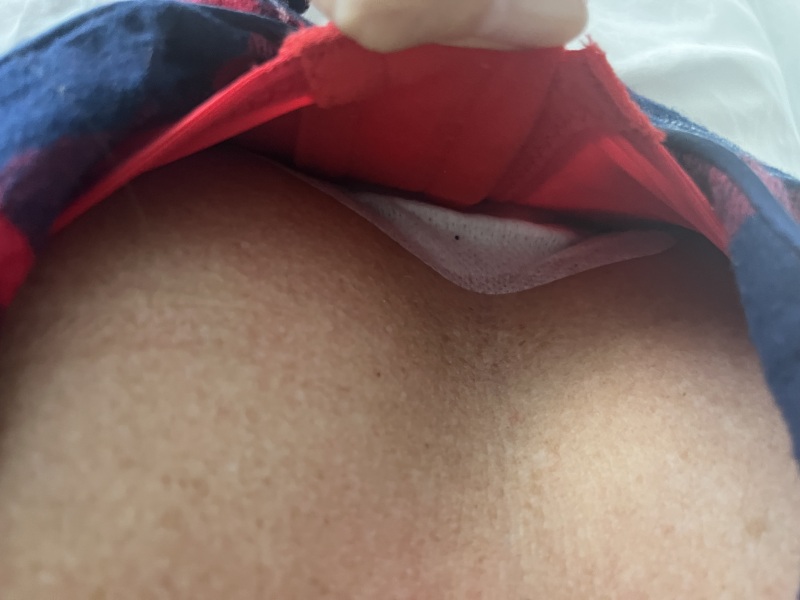 We’ve all had breast reductions - happy to help