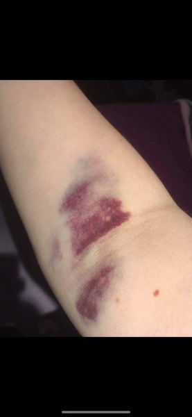 Been for a blood test, what has she done! Photo attached