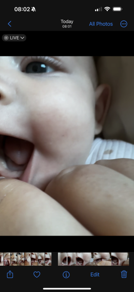 Tooth? Epstein pearls ? Or something else