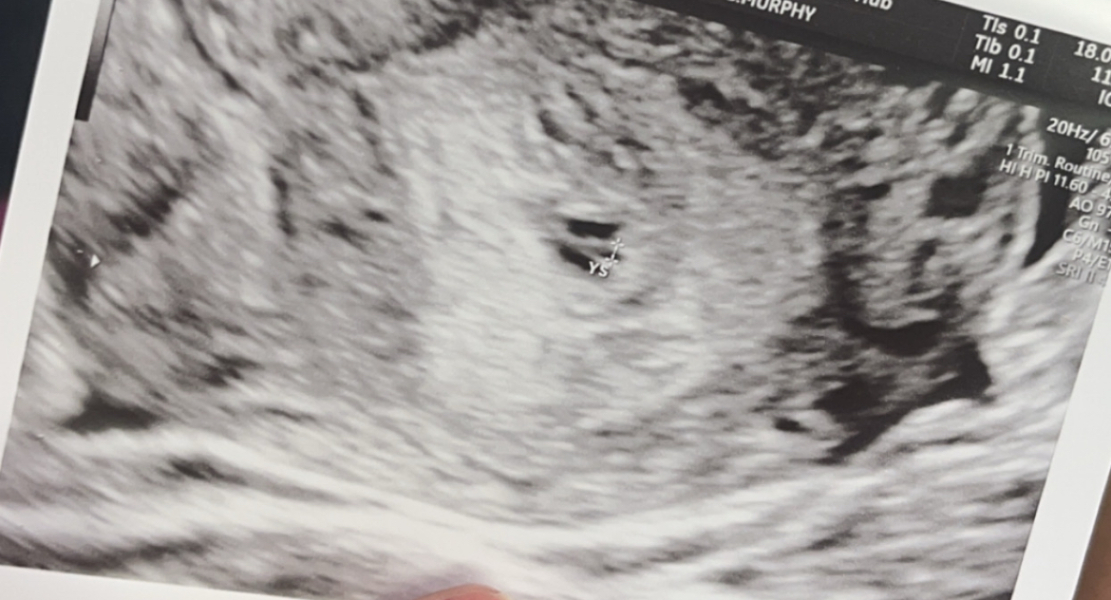 Pregnancy of unknown location? PLEASE HELP
