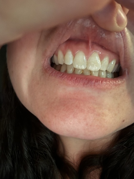 Teeth
