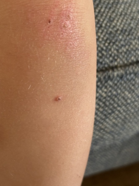 Does anyone know what this could be on 2yr olds knee?