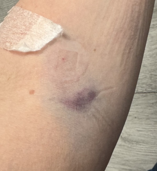 Been for a blood test, what has she done! Photo attached