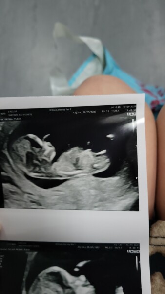 Boy or girl?